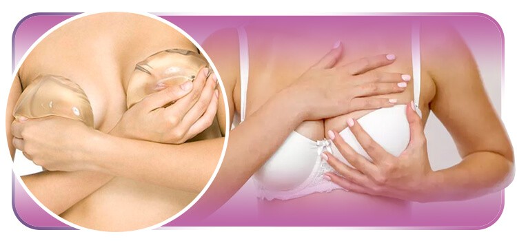 Explante de silicone: tudo o que você precisa saber